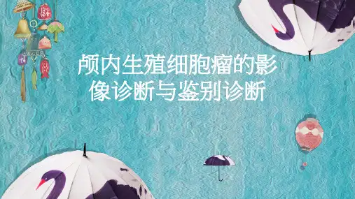 颅内生殖细胞瘤的影像诊断与鉴别诊断