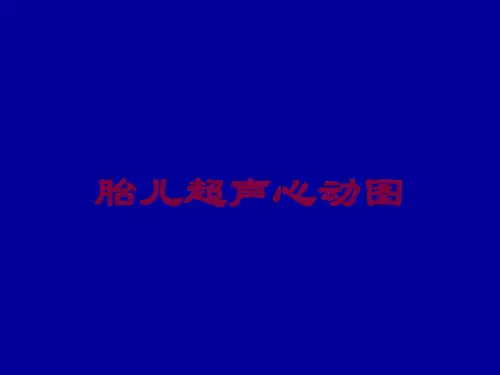 胎儿超声心动图培训课件