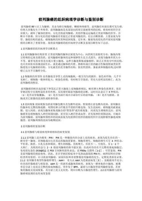 前列腺癌的组织病理学诊断与鉴别诊断