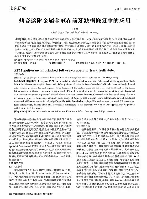 烤瓷熔附金属全冠在前牙缺损修复中的应用