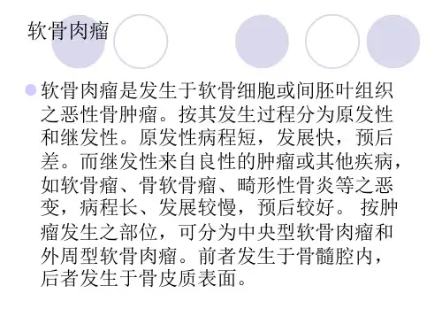 软骨肉瘤