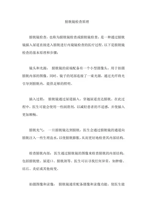 膀胱镜检查原理