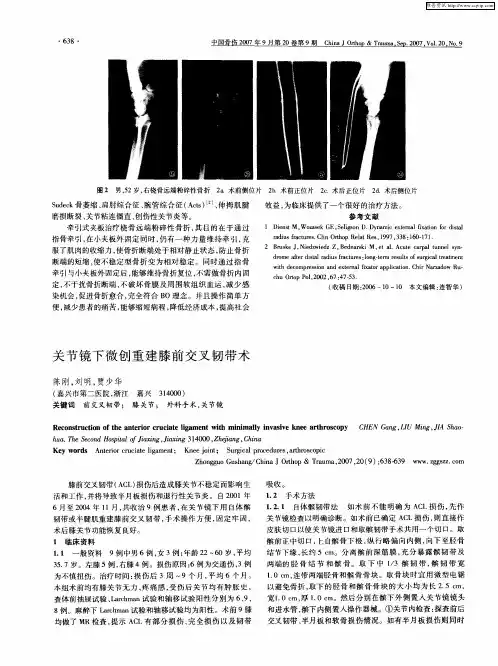 关节镜下微创重建膝前交叉韧带术