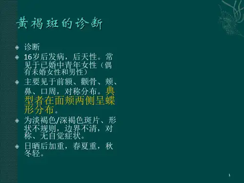 黄褐斑如何治疗PPT课件