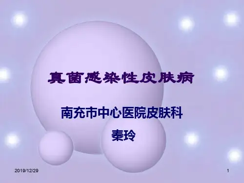 真菌感染性皮肤病ppt课件