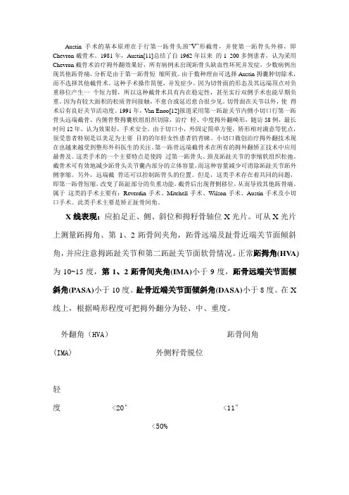 拇外翻截骨术