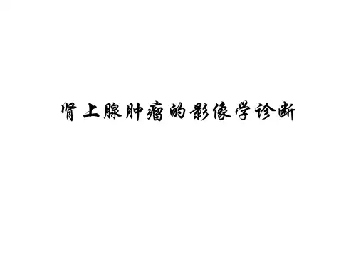 肾上腺肿瘤的影像学诊断