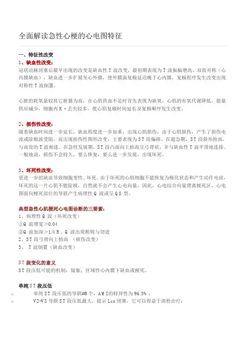 全面解读急性心梗的心电图特征