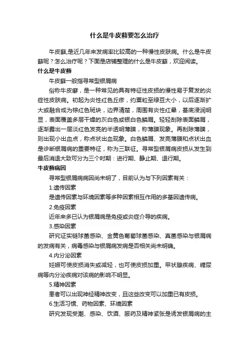 什么是牛皮藓要怎么治疗