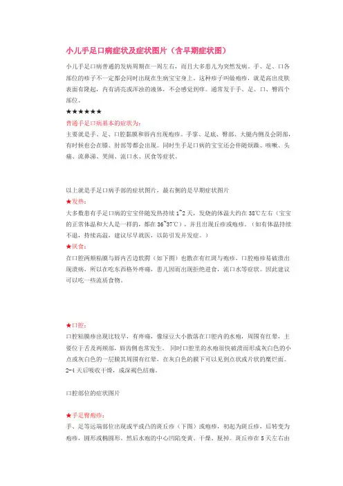 小儿手足口病症状及症状图片