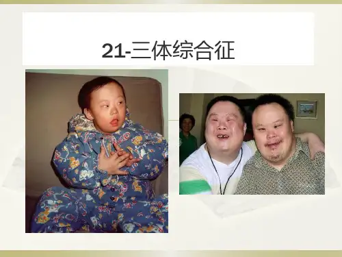 生物创新-21三体综合征课件