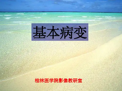呼吸系统常见病影像诊断基本病变