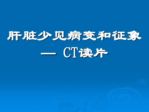 肝脏少见病变和征象
