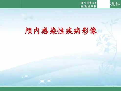 颅内感染性病变的影像诊断ppt课件