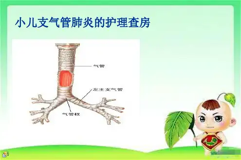 小儿急性支气管炎的护理查房