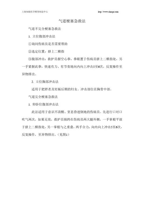 气道梗塞急救法