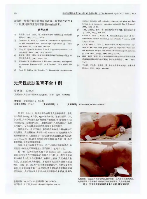 先天性皮肤发育不全1例