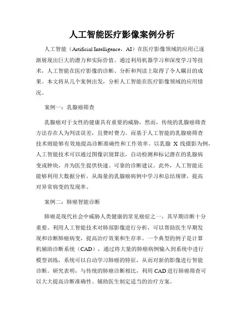 人工智能医疗影像案例分析