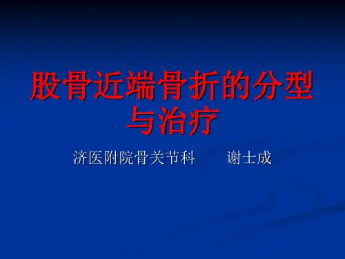 股骨近端骨折的分型与治疗