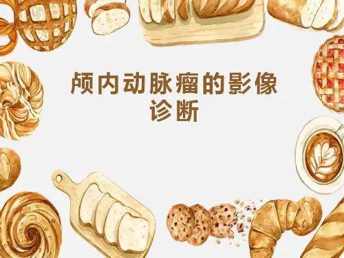 颅内动脉瘤的影像诊断与鉴别诊断