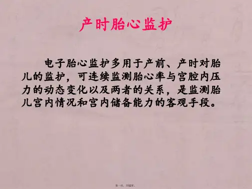 产时胎心监护