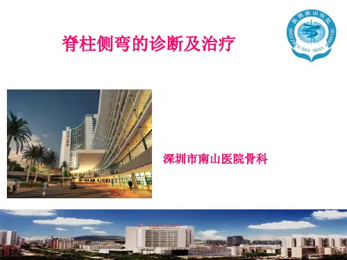 脊柱侧弯的诊断及治疗