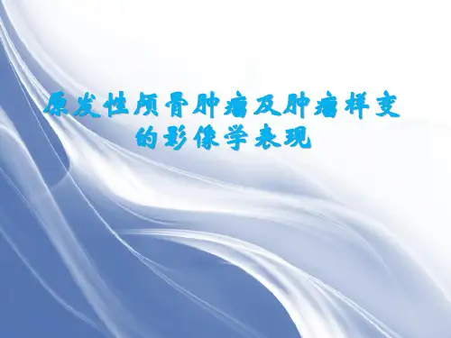 最新 原发性颅骨肿瘤及肿瘤样变的影像学表现 课件