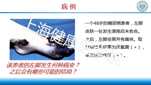 2.损伤(2)