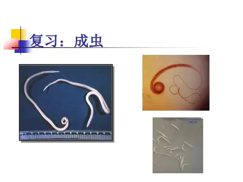 人体寄生虫：钩虫、丝虫