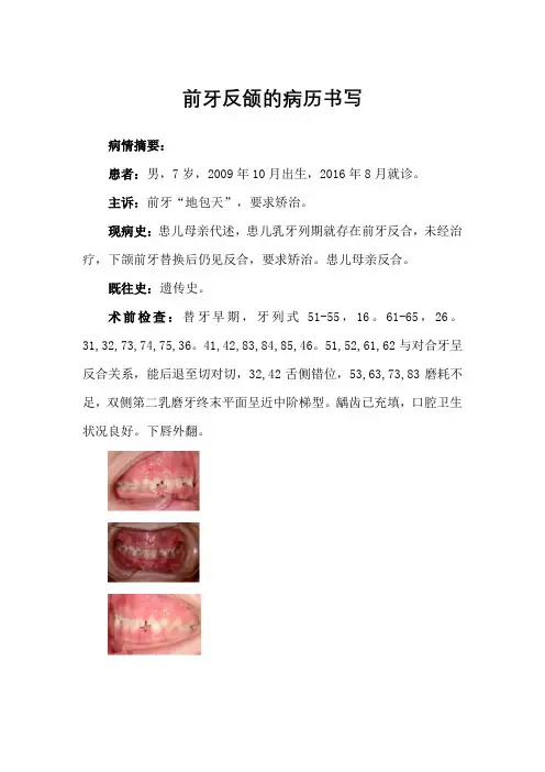前牙反颌的病历书写