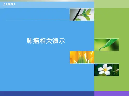 肺癌的护理查房PPT