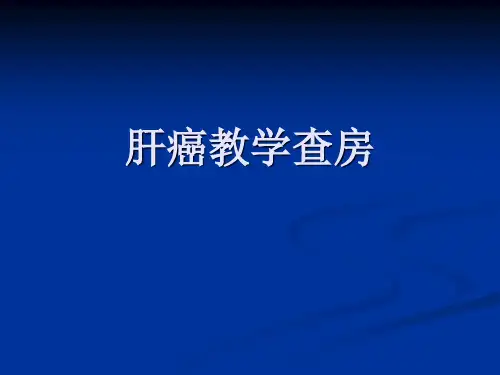 肝癌---教学查房