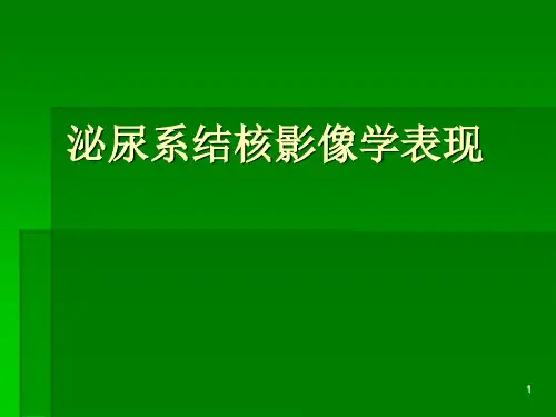 (推荐课件)泌尿系统结核的影像诊断PPT幻灯片