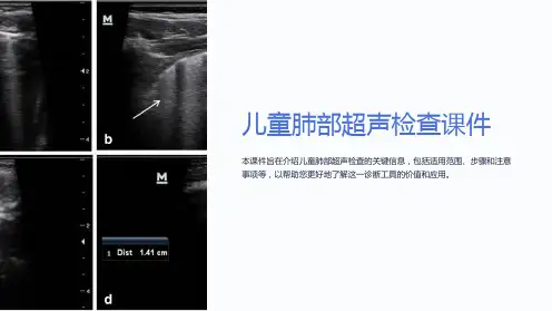 “儿童肺部超声检查课件”