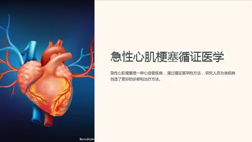 急性心肌梗塞循证医学