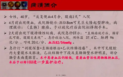 脓毒性心肌病