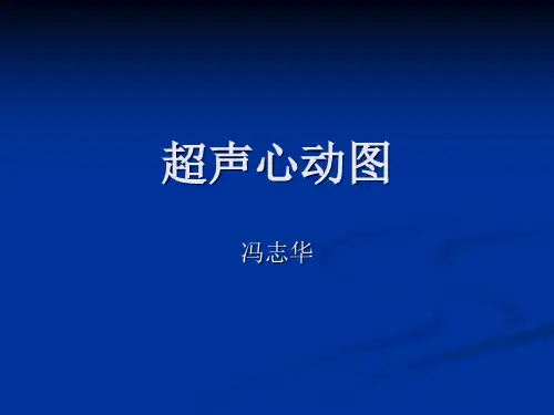 超声心动图