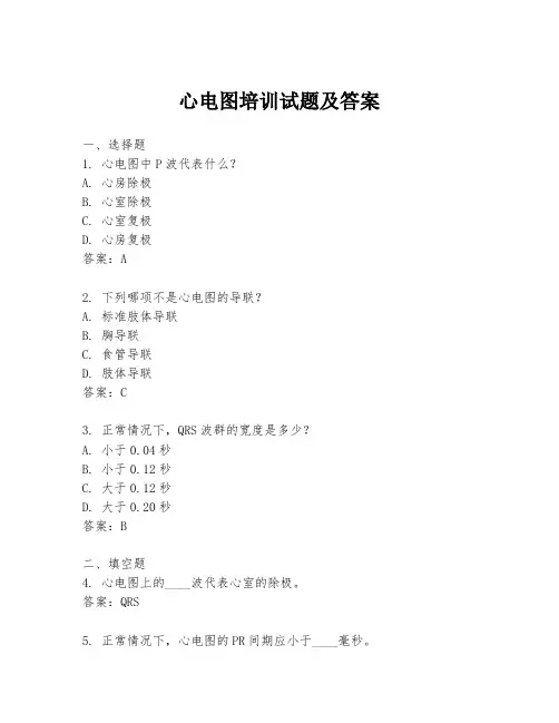 心电图培训试题及答案