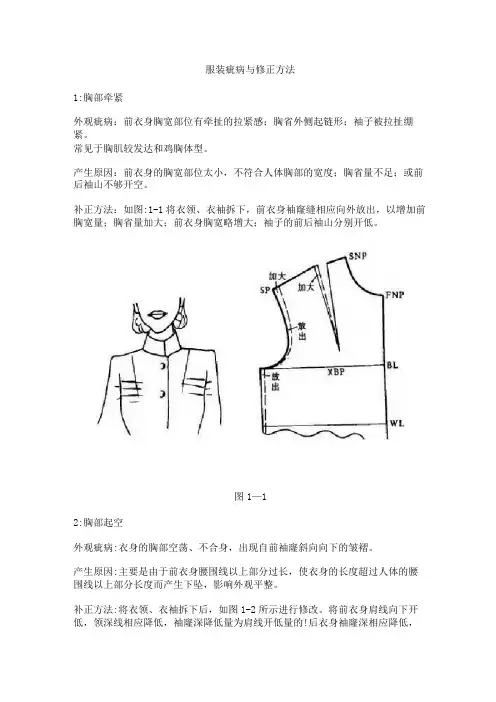 服装疵病与修正方法