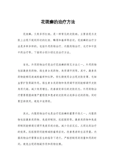 花斑癣的治疗方法
