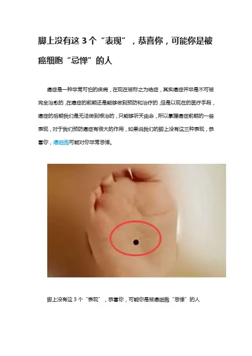 脚上没有这3个“表现”,恭喜你,可能你是被癌细胞“忌惮”的人