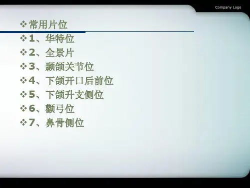 颌面骨折PPT课件
