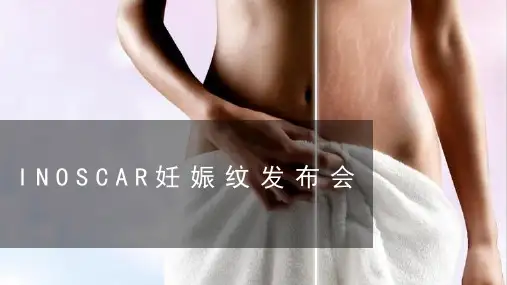 产后妊娠纹修复与治疗