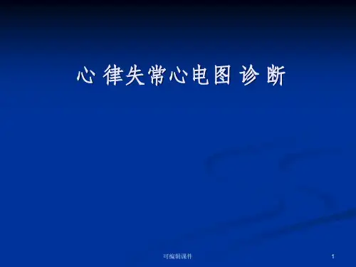 心律失常 分类ppt课件
