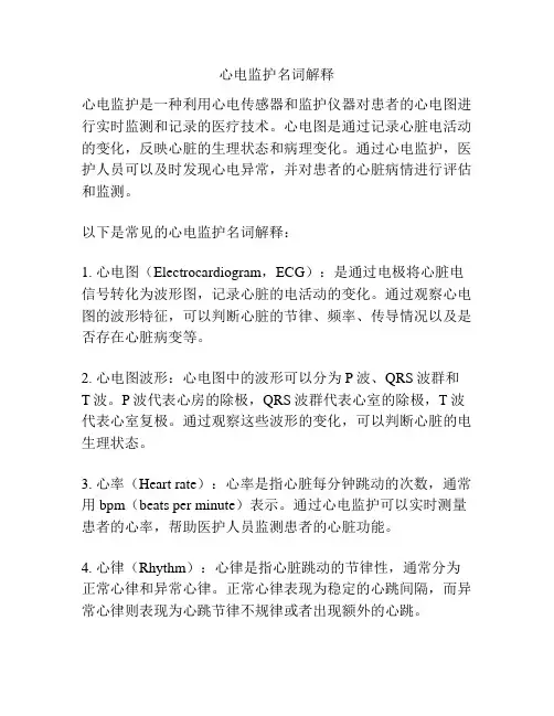 心电监护名词解释