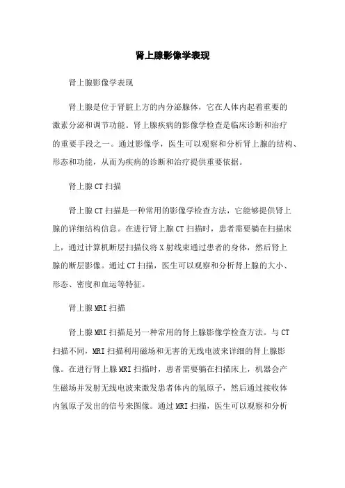 肾上腺影像学表现