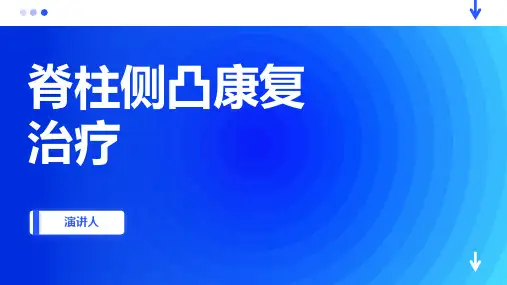 脊柱侧凸康复治疗