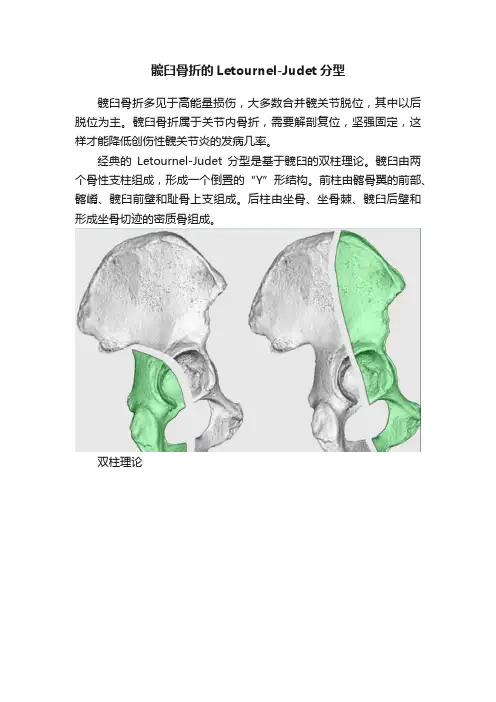 髋臼骨折的Letournel-Judet分型