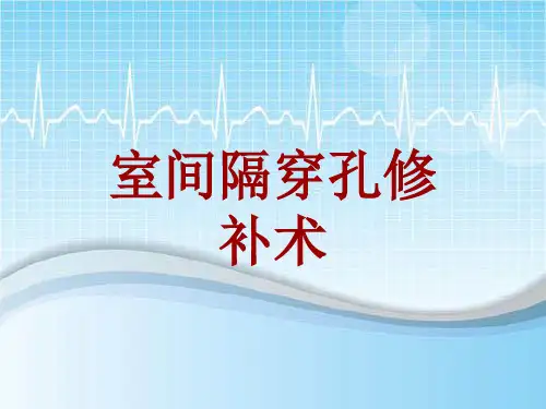 外科手术教学资料：室间隔穿孔修补术讲解模板