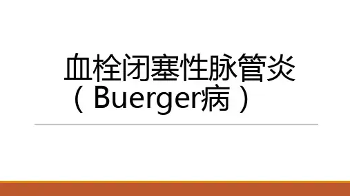 血栓闭塞性脉管炎(Buerger病)